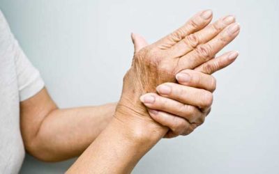 Recomendaciones sobre la artritis